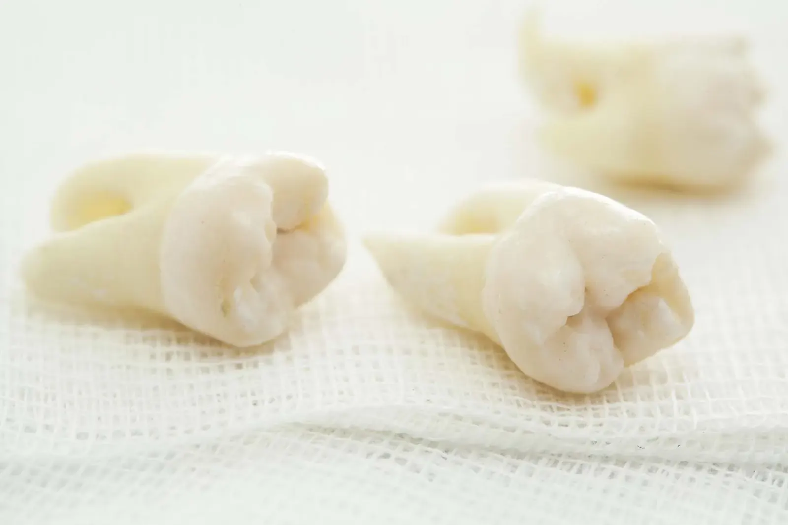 Gentle Wisdom Tooth Removal in Newkirk, OK